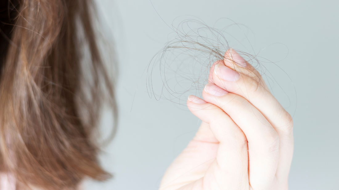 hair loss from stress female