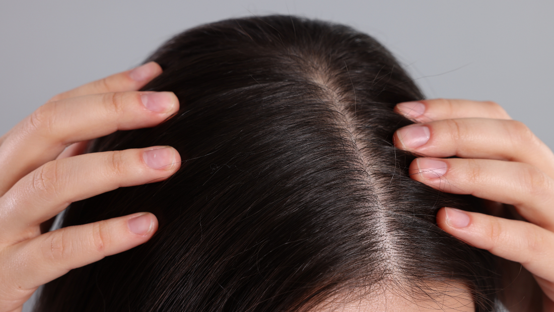 Scalp Care Essentials: Preventing Hair Loss Through Proper Scalp Maintenance